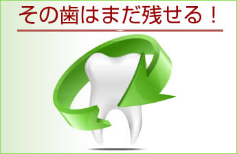 その歯はｍだ残せる